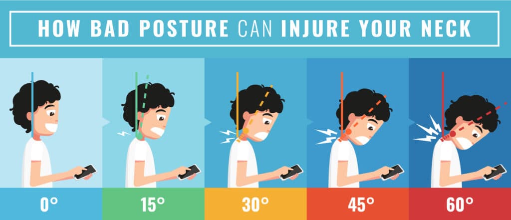 Tech Neck & Text Neck: The Hidden Neck Strain of the Smartphone Era